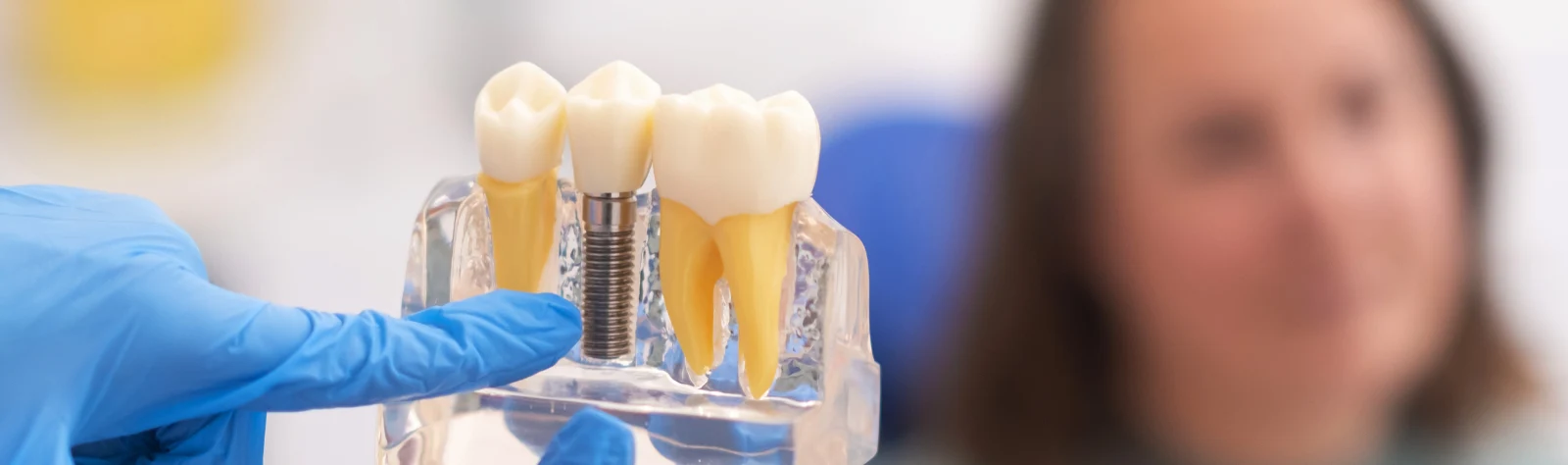 Aparatología dental